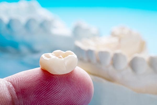 Restorative Dentistry