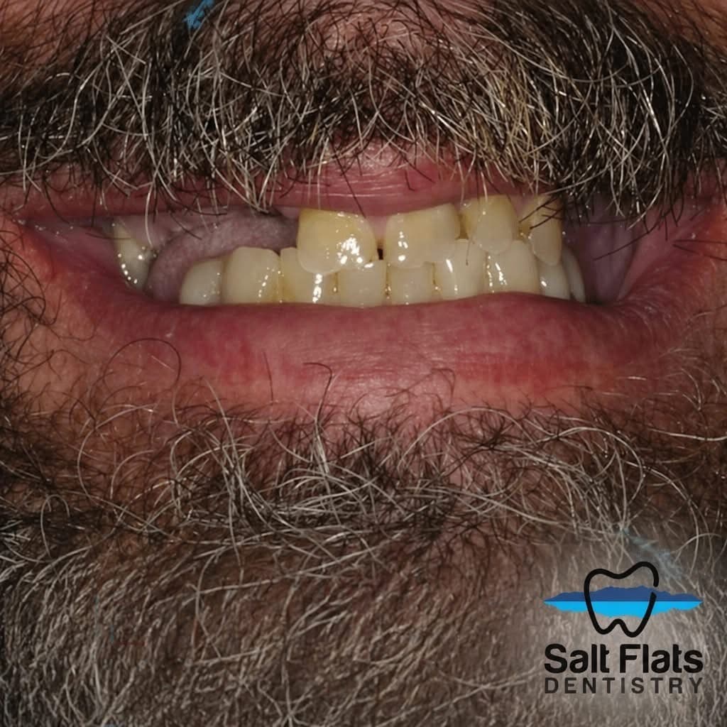 Patient smile transformation before
