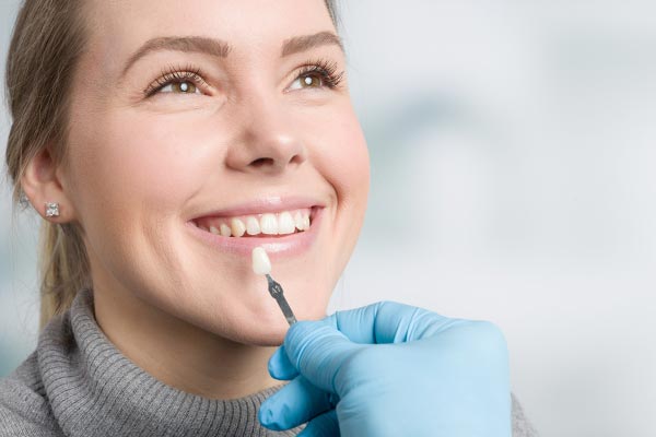 Veneers